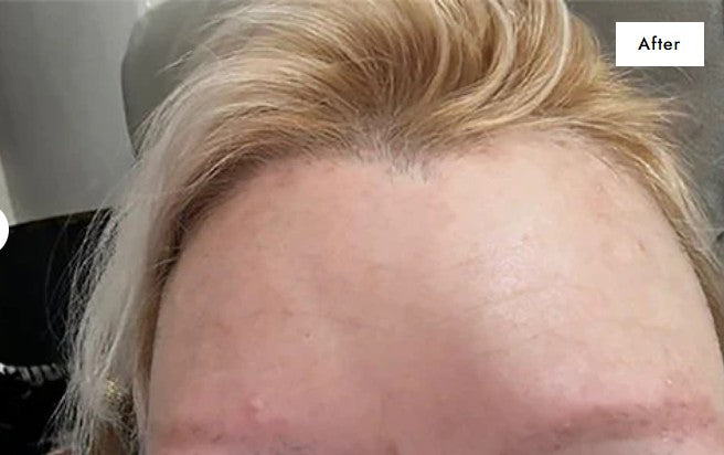 collagen after.jpg