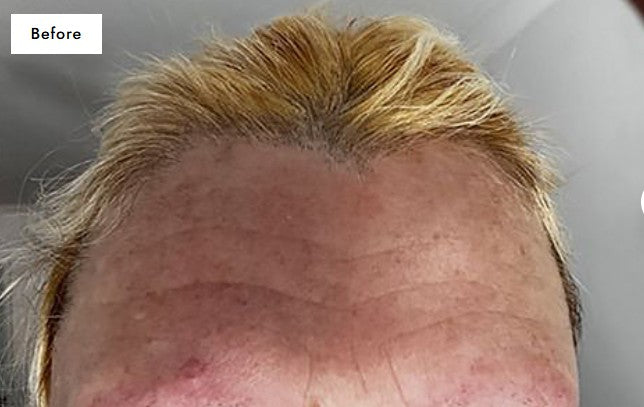 collagen supplements before.jpg