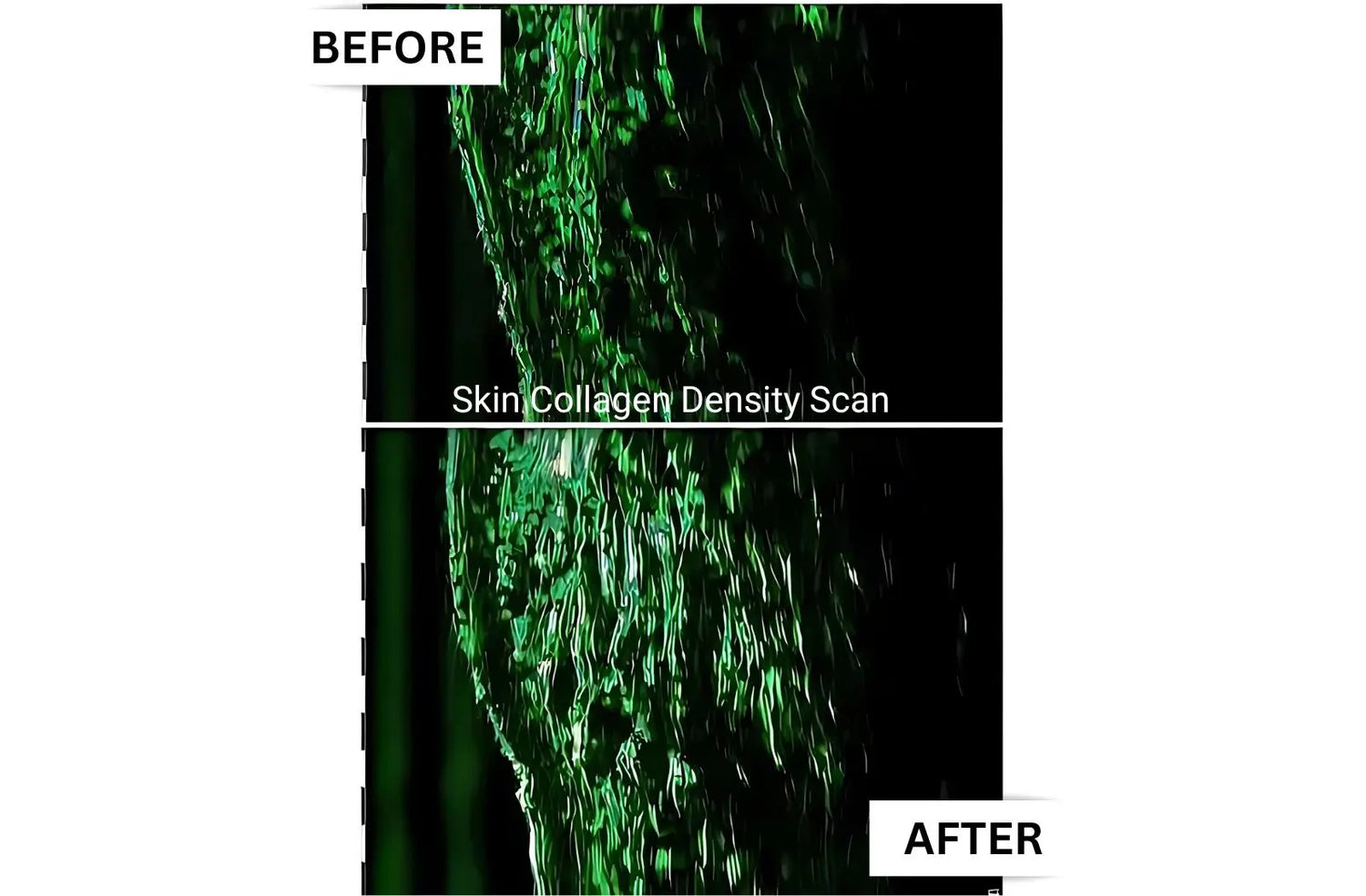 best collagen supplement for wrinkles UK, marine liquid collagen, before and after skin hair nails