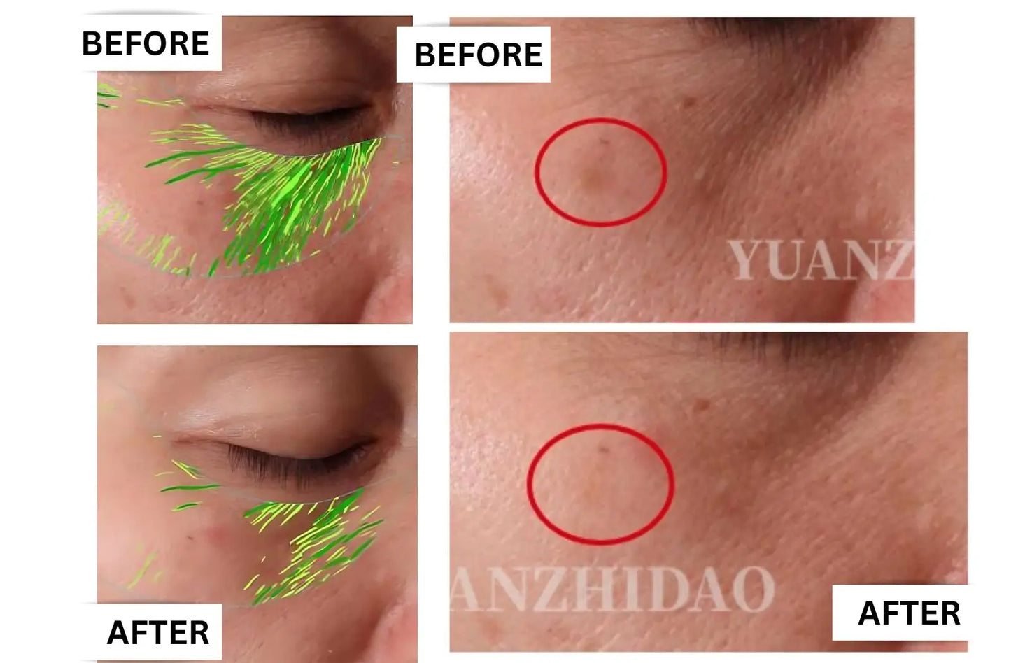 best collagen supplement for wrinkles UK, marine liquid collagen, before and after