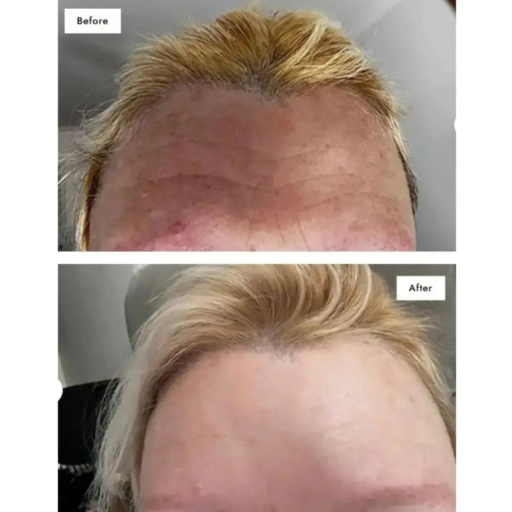 Best Collagen For Wrinkles – 93% Saw Fewer Wrinkles in Just 28 Days