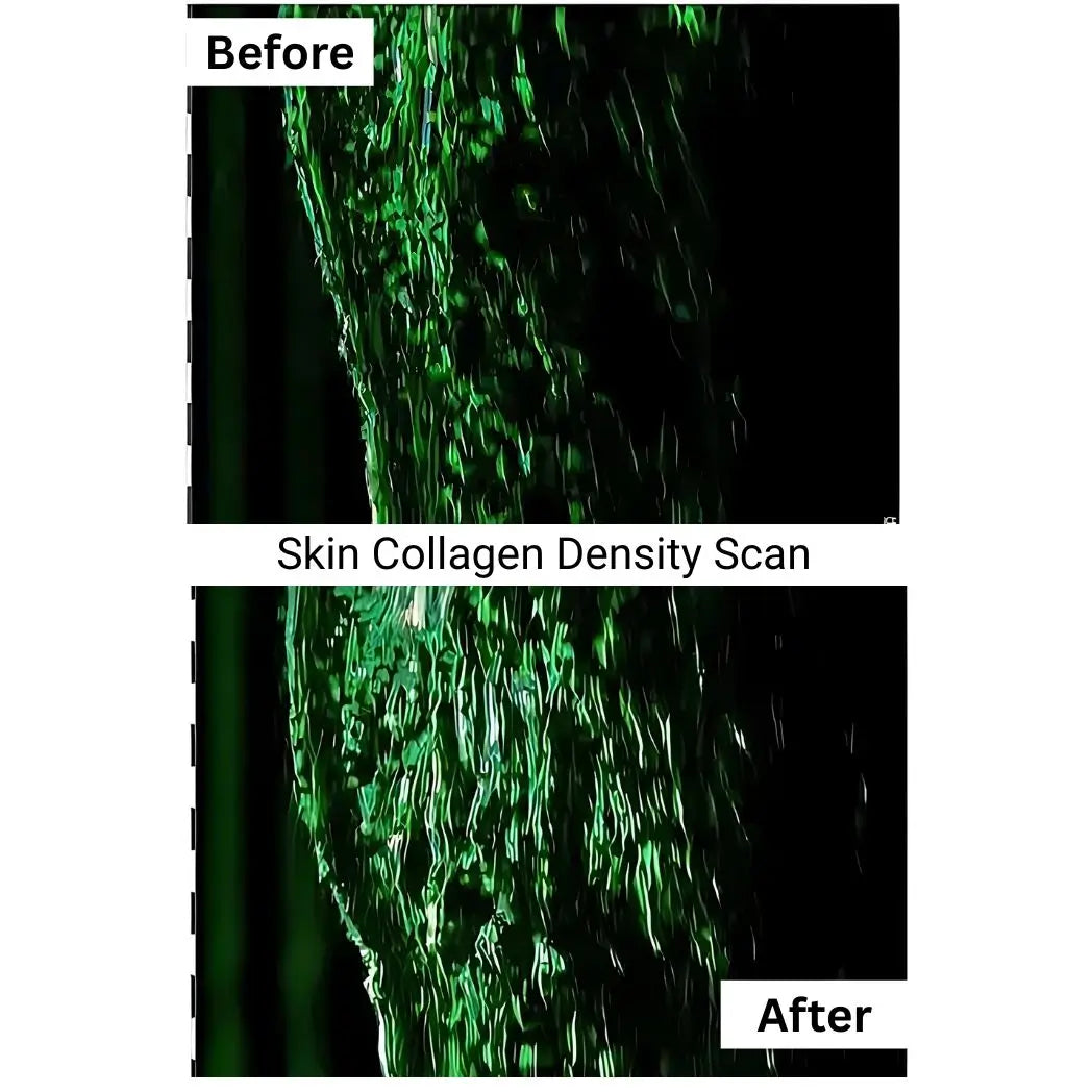 Multi-Award-Winning Collagen – 93% Saw Fewer Wrinkles in Just 28 Days