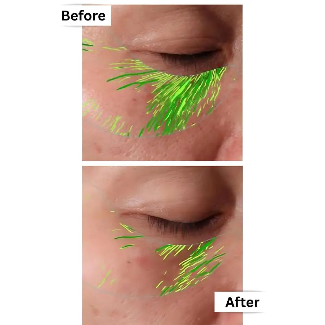Multi-Award-Winning Collagen – 93% Saw Fewer Wrinkles in Just 28 Days