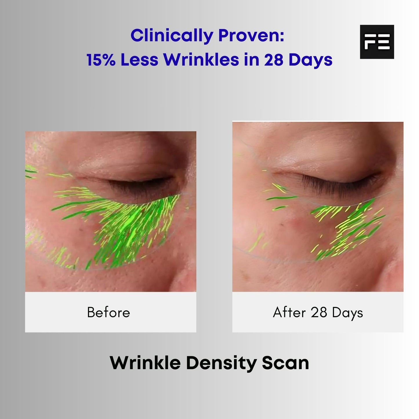 Best Collagen For Wrinkles – 8000mg Tri-Peptide – 14 x 21ml Sachets