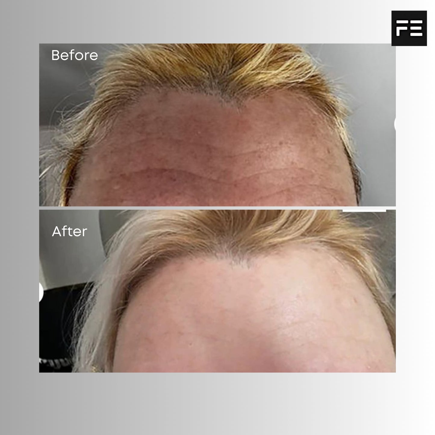 Best Collagen For Wrinkles – 8000mg Tri-Peptide – 14 x 21ml Sachets