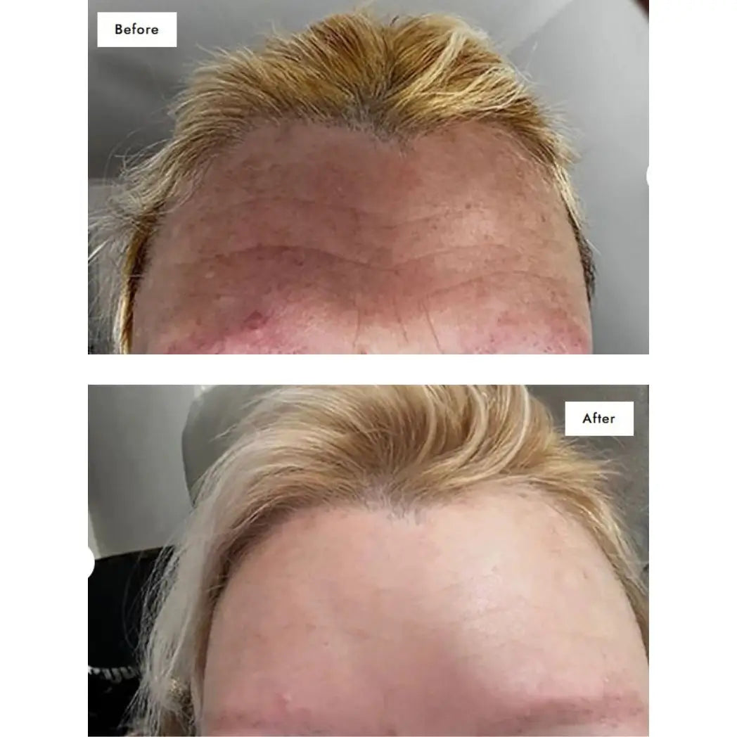 Multi-Award-Winning Collagen – 93% Saw Fewer Wrinkles in Just 28 Days