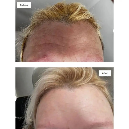 Multi-Award-Winning Collagen – 93% Saw Fewer Wrinkles in Just 28 Days