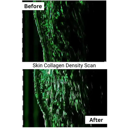 Multi-Award-Winning Collagen – 93% Saw Fewer Wrinkles in Just 28 Days